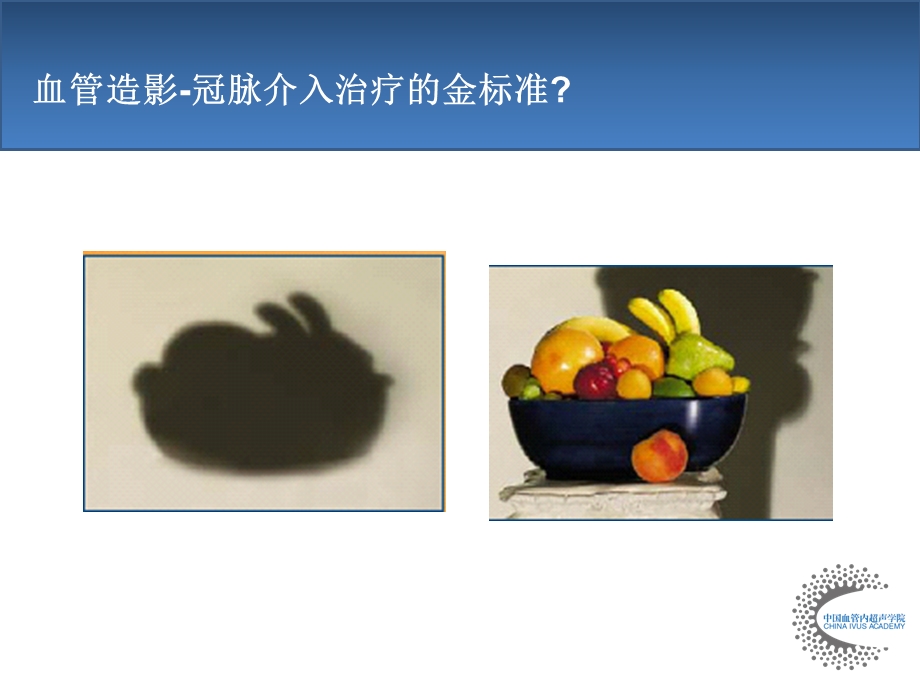 IVUS原理和应用.ppt_第3页