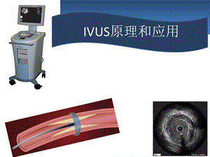 IVUS原理和应用.ppt