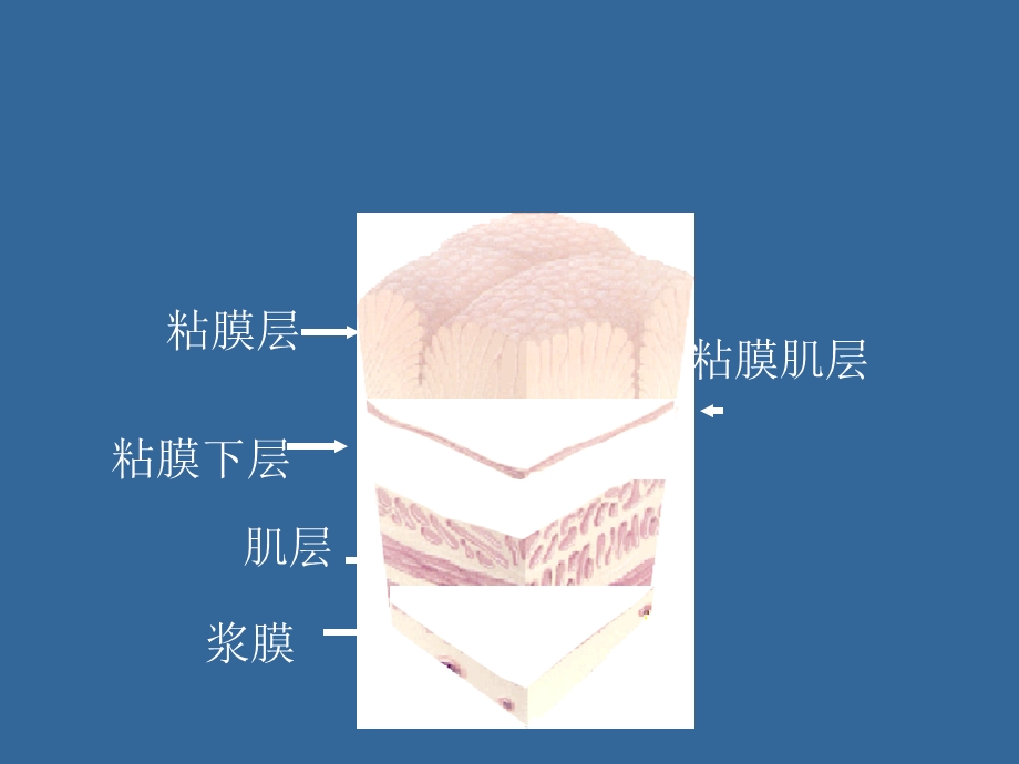 《护理消化》PPT课件.ppt_第3页