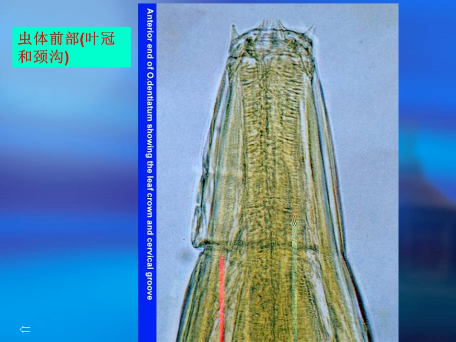 《牛羊食道口线虫病》PPT课件.ppt_第3页