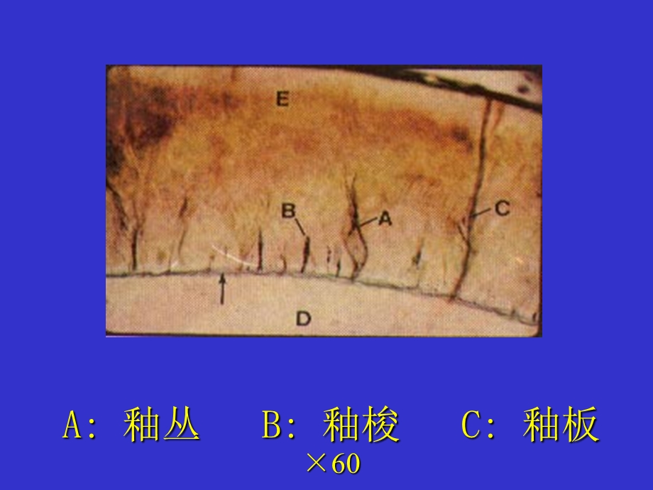 《牙本质牙髓牙骨质》PPT课件.ppt_第1页