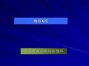 《胸部X线诊断》PPT课件.ppt