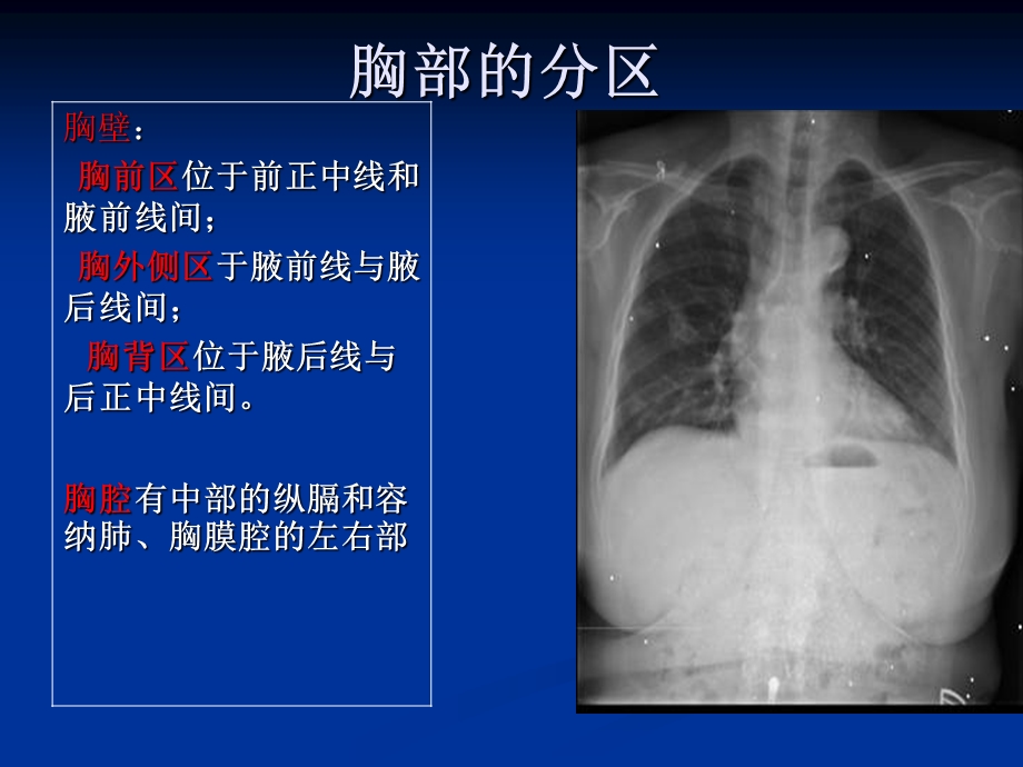 胸部局部解剖.ppt_第3页