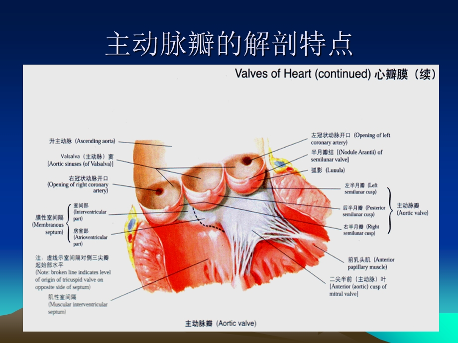 《主动脉瓣疾病》PPT课件.ppt_第3页