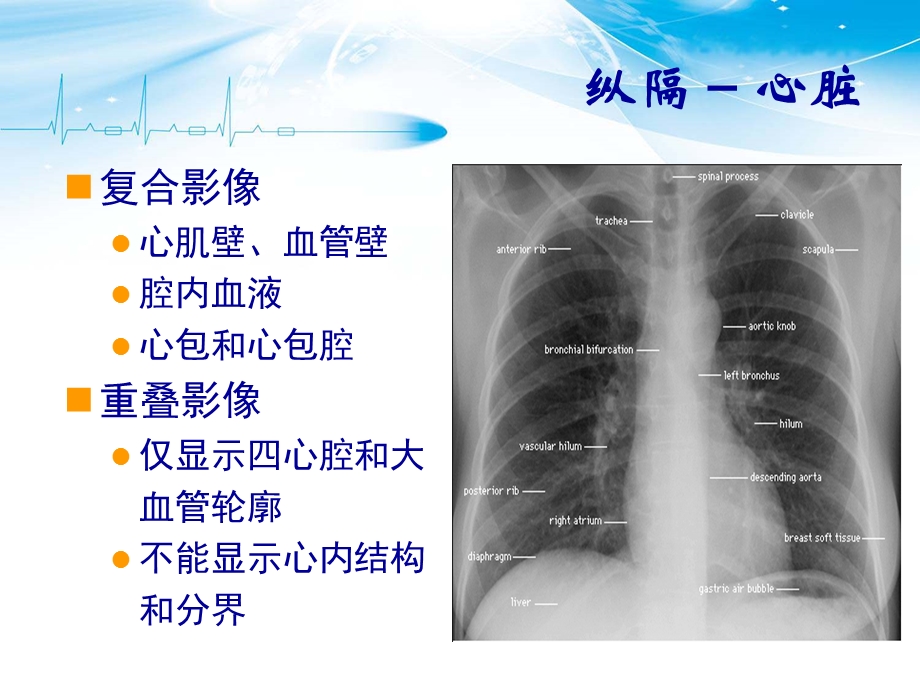 《胸部CT解剖》PPT课件.ppt_第1页