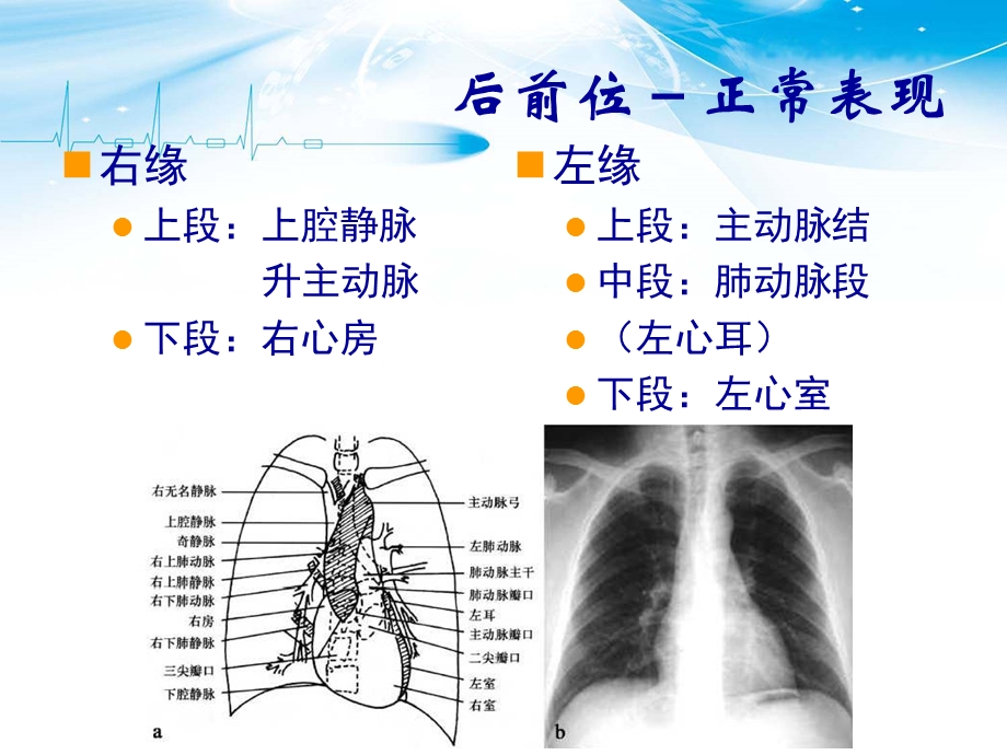 《胸部CT解剖》PPT课件.ppt_第3页