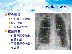 《胸部CT解剖》PPT课件.ppt