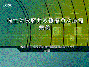 胸主动脉瘤并双侧髂总动脉瘤病例.ppt