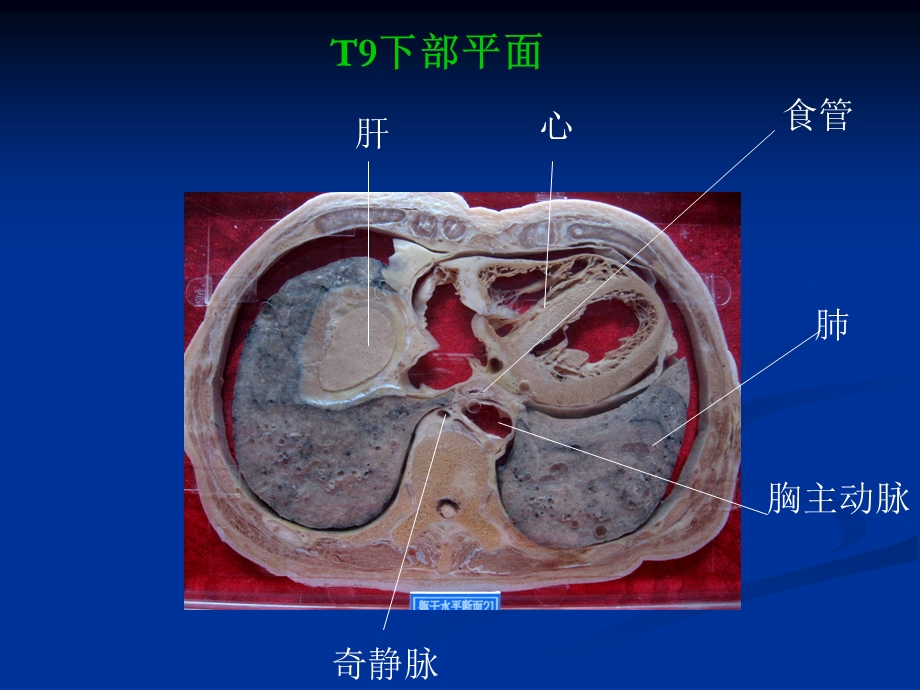 《断层解剖高清图》PPT课件.ppt_第2页