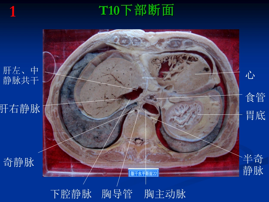 《断层解剖高清图》PPT课件.ppt_第3页