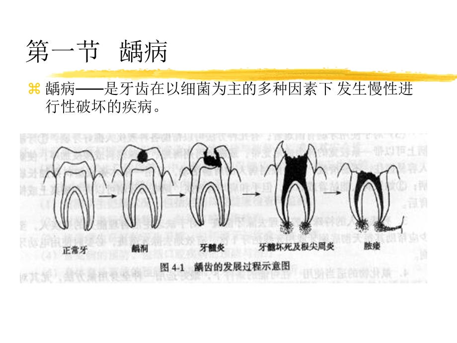 《牙体常见病》PPT课件.ppt_第2页