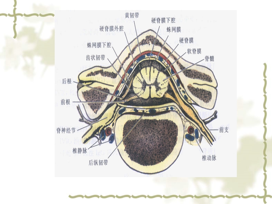 《脊髓血管病》PPT课件.ppt_第3页