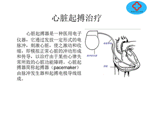 心脏起搏治疗.ppt