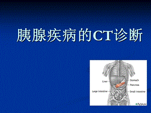 《胰腺疾病CT诊断》PPT课件.ppt