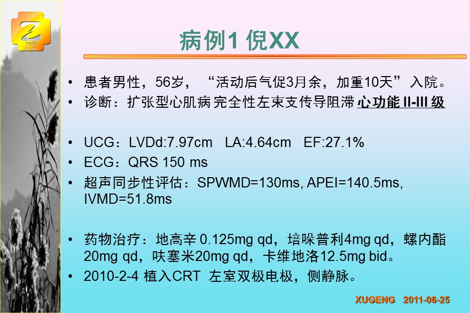 轻度心衰CRT时机已经来到最新循证医学证据解读课件.ppt_第3页