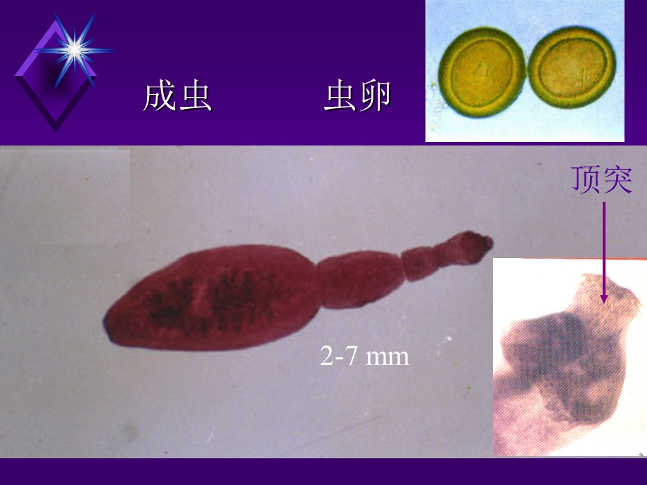 《细粒微小中》PPT课件.ppt_第3页