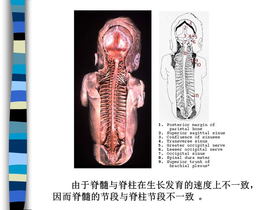 《脊髓病基础知识》PPT课件.ppt_第3页