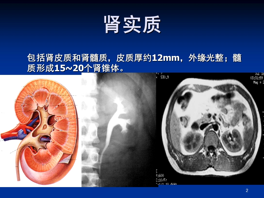 《泌尿系统影像》PPT课件.ppt_第2页