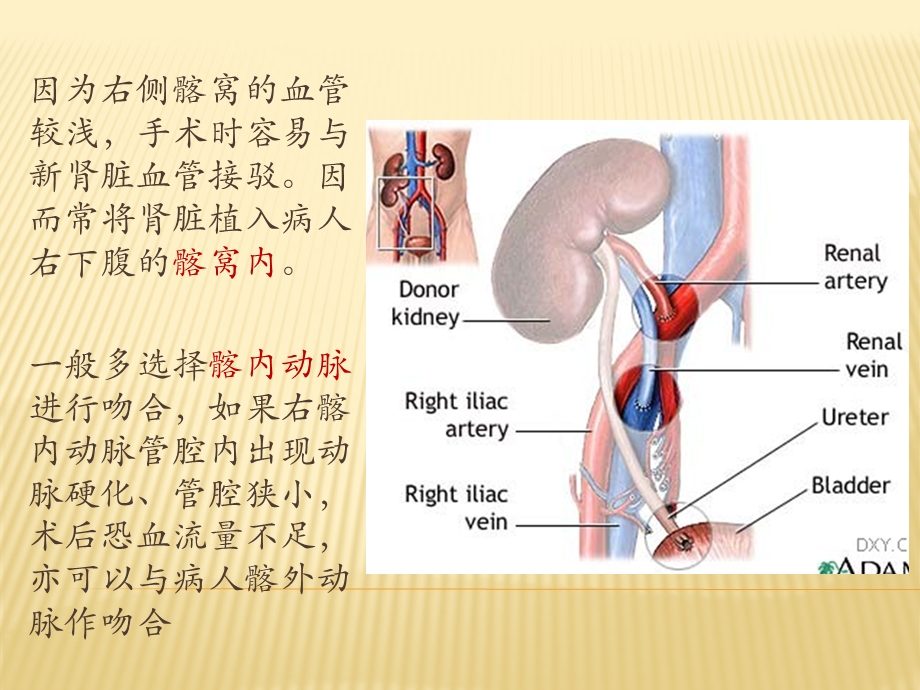 肾移植简介.ppt_第2页