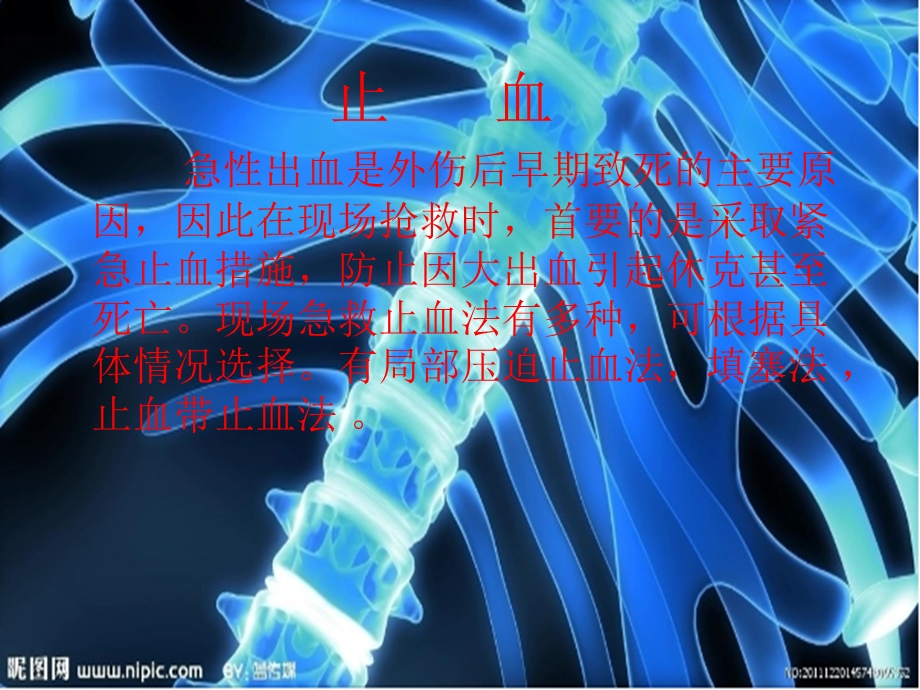 胸部、上肢的包扎.ppt_第3页