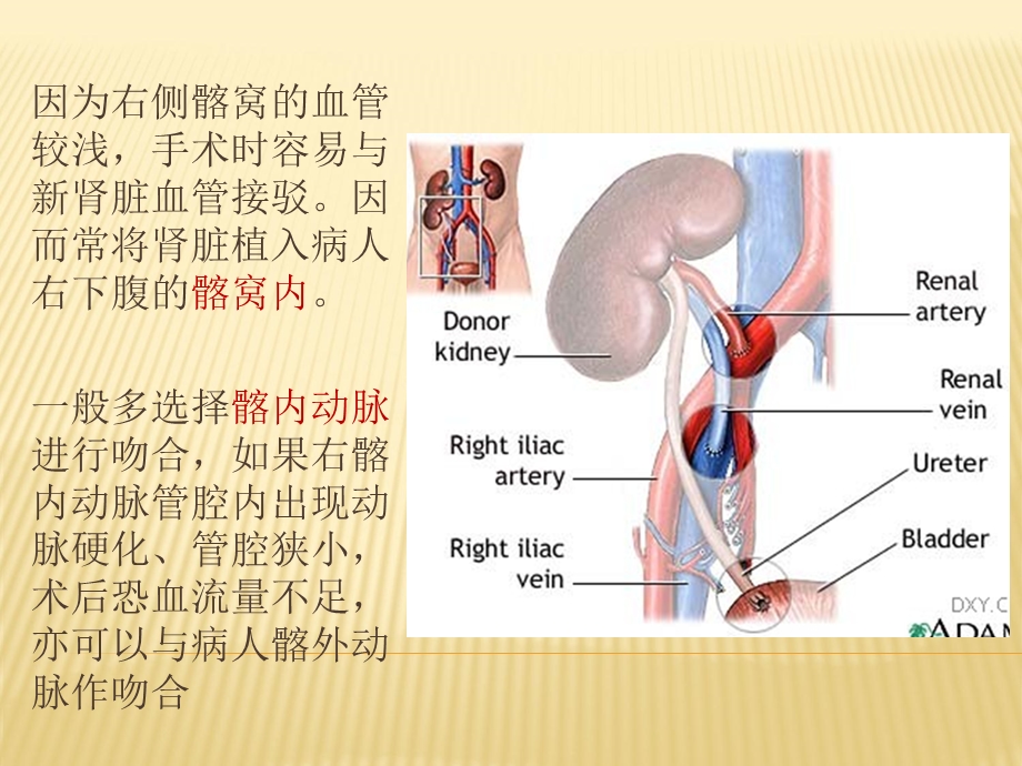 《肾移植简介》PPT课件.ppt_第2页