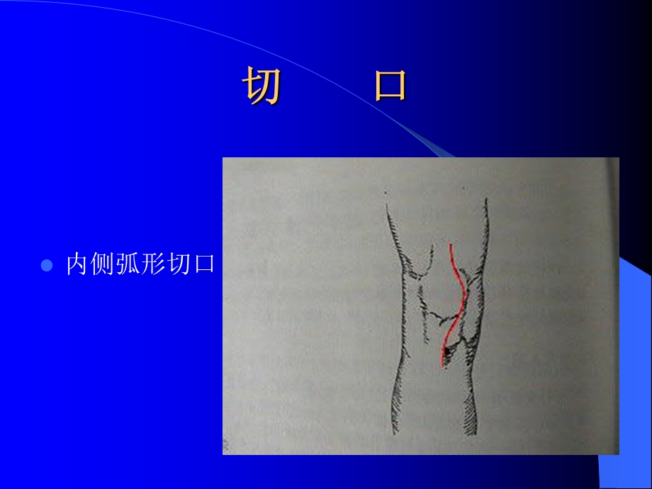 膝关节操作.ppt_第2页