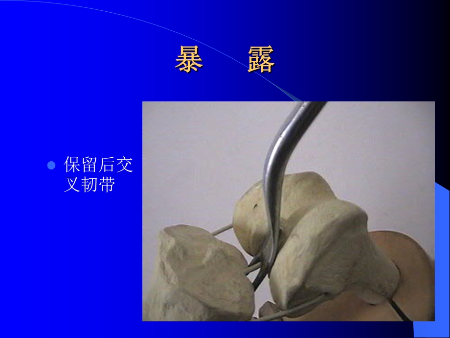 膝关节操作.ppt_第3页