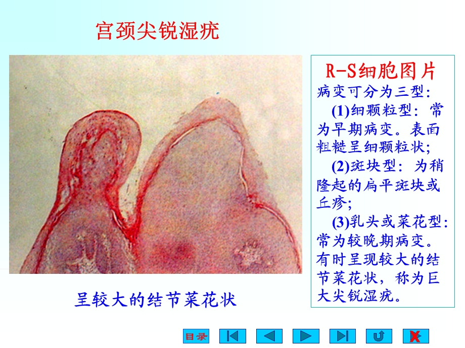 09生殖系统及乳腺疾病文档资料.ppt_第2页