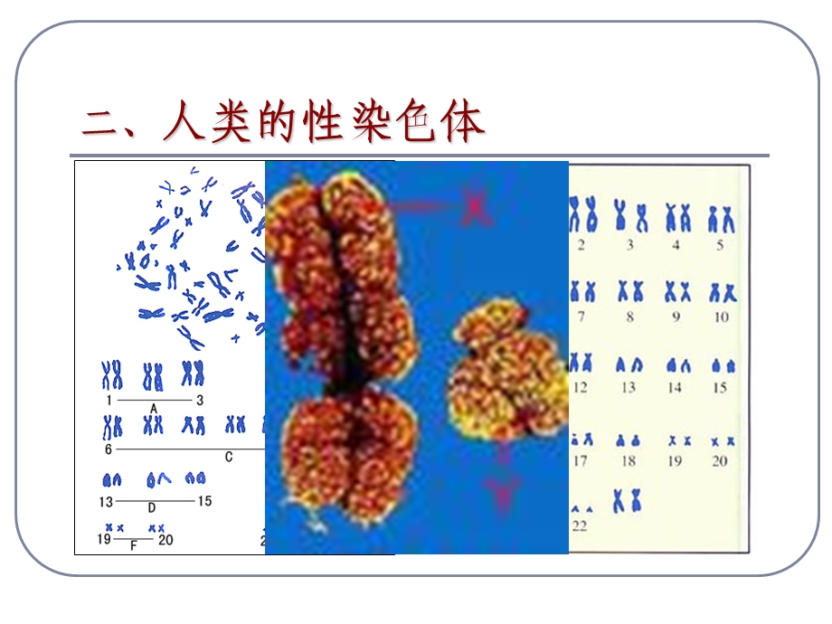 医学课件第3节伴性遗传.ppt_第2页