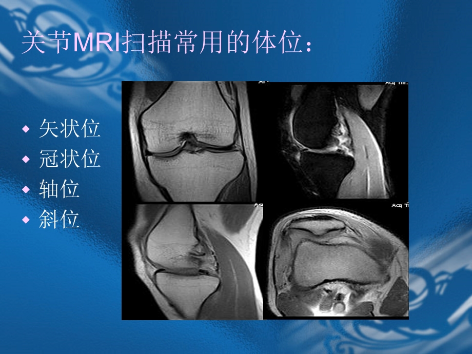 MRI骨关节影像诊断文档资料.ppt_第3页