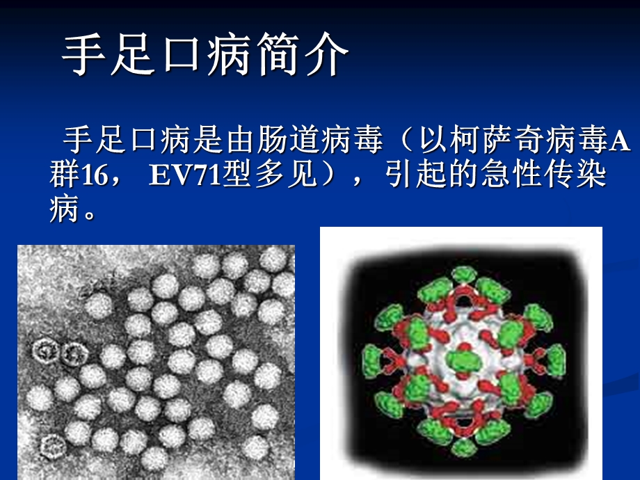 农村讲堂手足口病培训名师编辑PPT课件.ppt_第2页