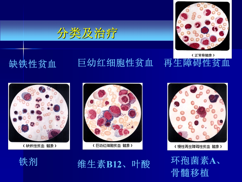 临床药理学第27章 血液系统疾病的临床用药文档资料.ppt_第2页