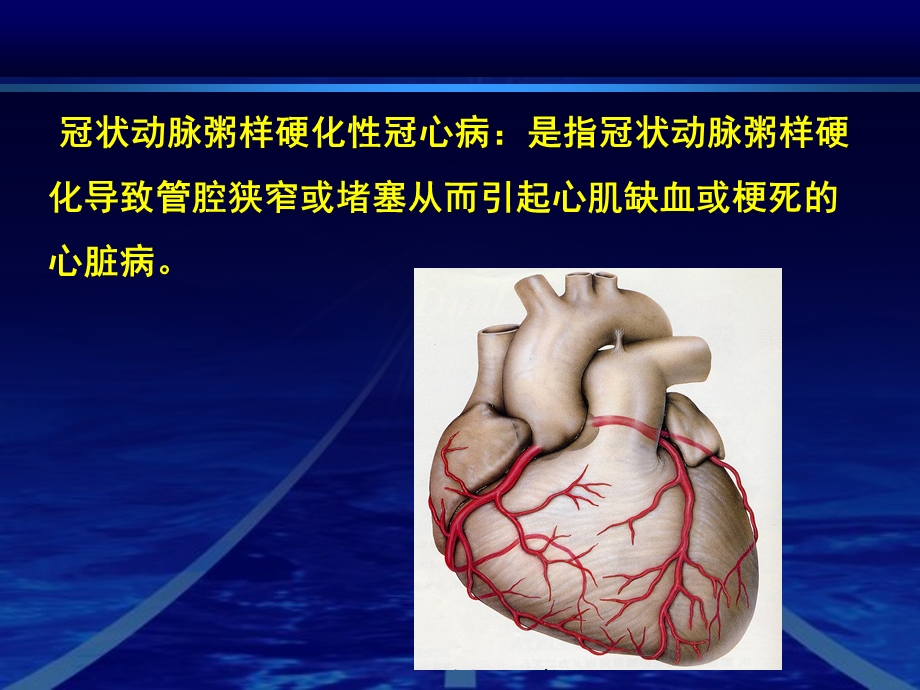 冠心病急例会名师编辑PPT课件.ppt_第2页