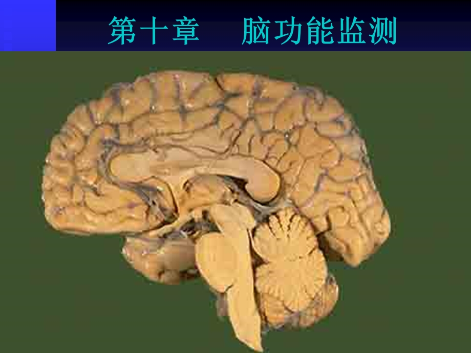 医学课件第10章　脑功能监测.ppt_第1页