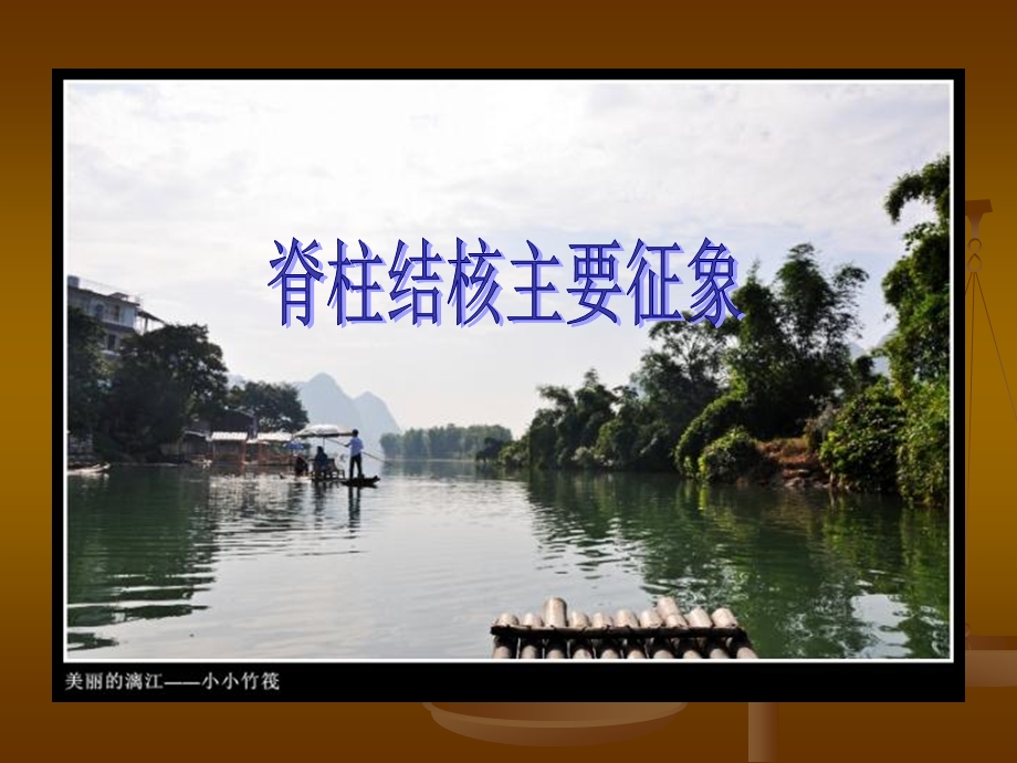 MRI读片骨关节4名师编辑PPT课件.ppt_第2页