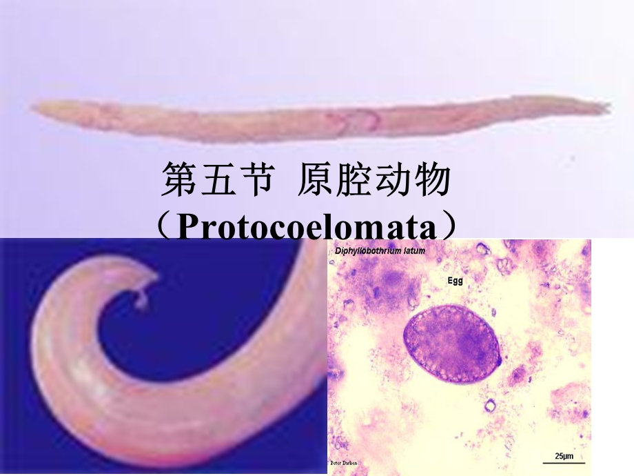 医学课件第五部分原腔动物Protocoelomata.ppt_第1页