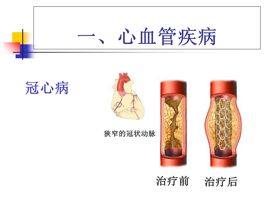 1612健康管理营慢性病的预防与调理精选文档文档资料.ppt_第3页