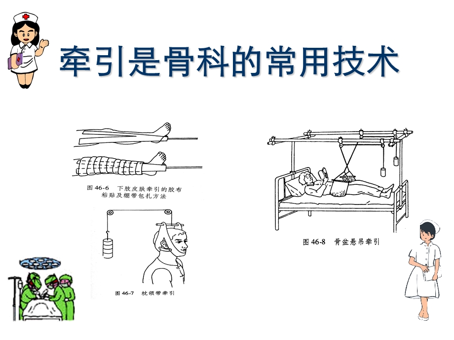 骨科常见牵引的种类及方法.ppt_第2页