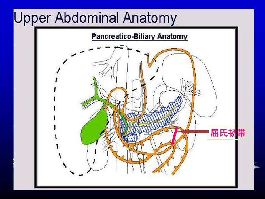 上消化道出血1名师编辑PPT课件.ppt_第3页