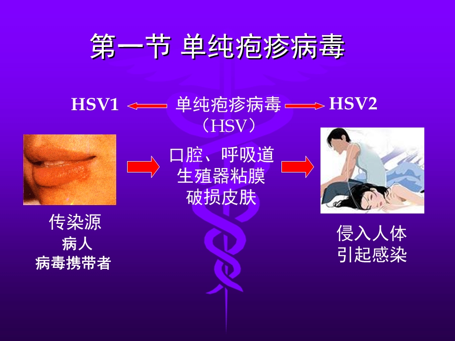 医学课件第二十一部分疱疹病毒.ppt_第3页