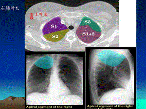 CT正常彩色肺段解剖谱课件精选文档.ppt