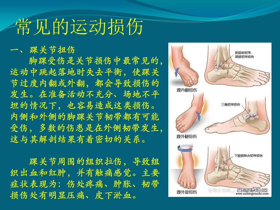 hw常见损伤的应急处理与急救pptPPTPPT文档.ppt_第1页