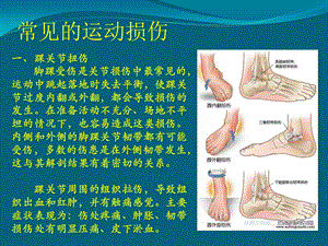 hw常见损伤的应急处理与急救pptPPTPPT文档.ppt