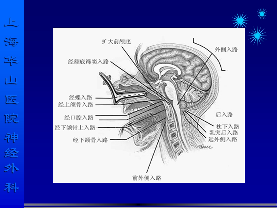 CPA肿瘤的现代治疗精选文档.ppt_第3页