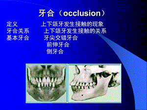 牙合occlusion.ppt