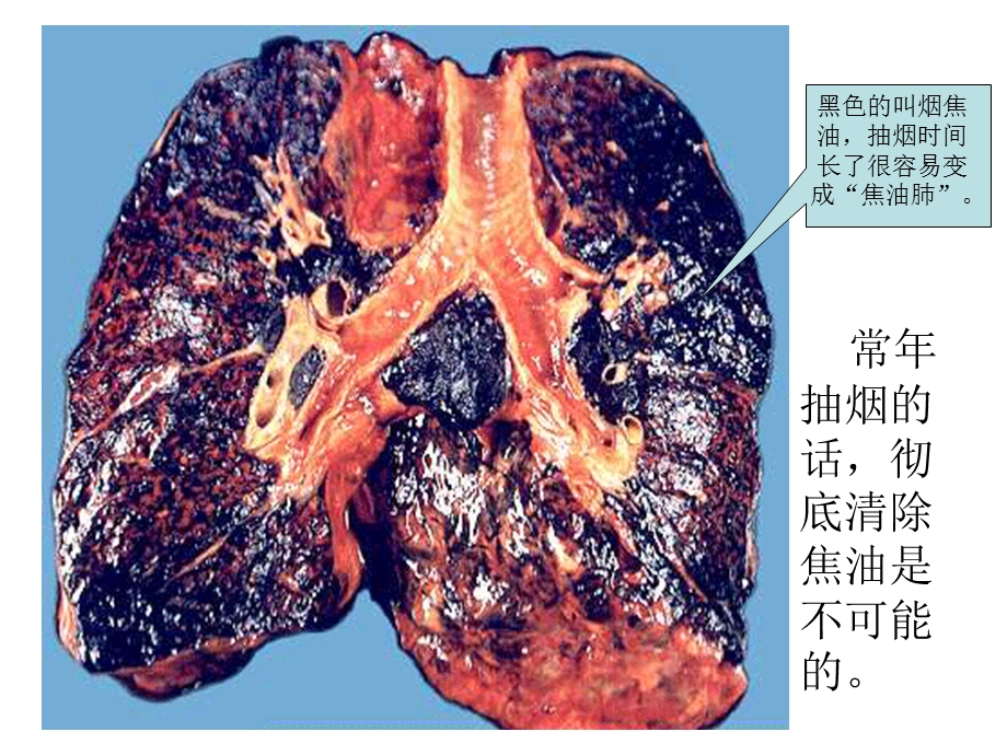 初中生健康教育吸烟有害健康.ppt_第3页