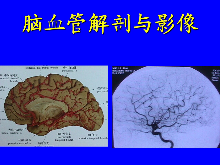 《颈内动脉解剖》PPT课件.ppt_第1页