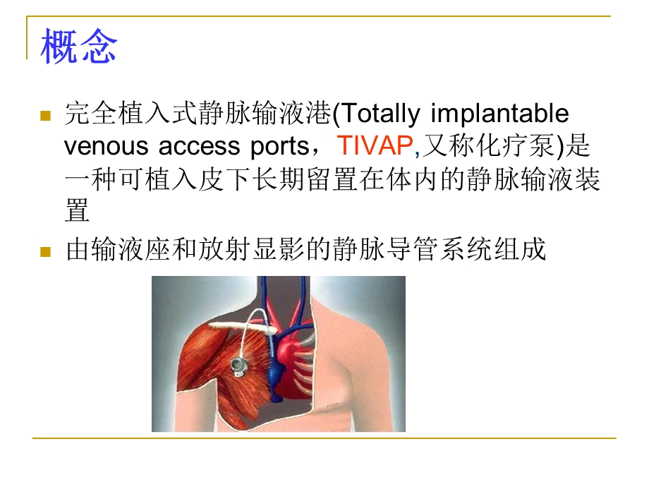 《输液港护理》PPT课件.ppt_第3页