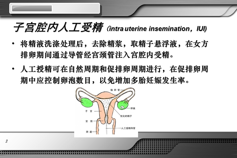 《辅助生殖技术》PPT课件.ppt_第3页