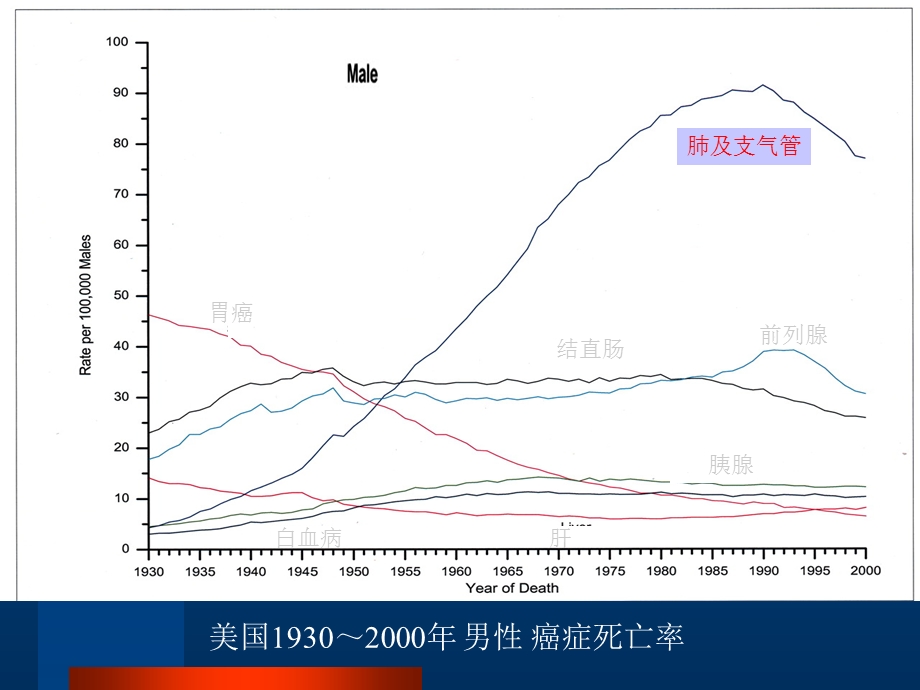 《肺癌本科》PPT课件.ppt_第2页